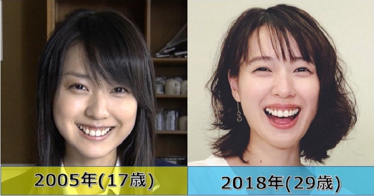 戸田恵梨香が歯肉手術した 今と昔の歯茎画像を作品別にまとめ 比較検証
